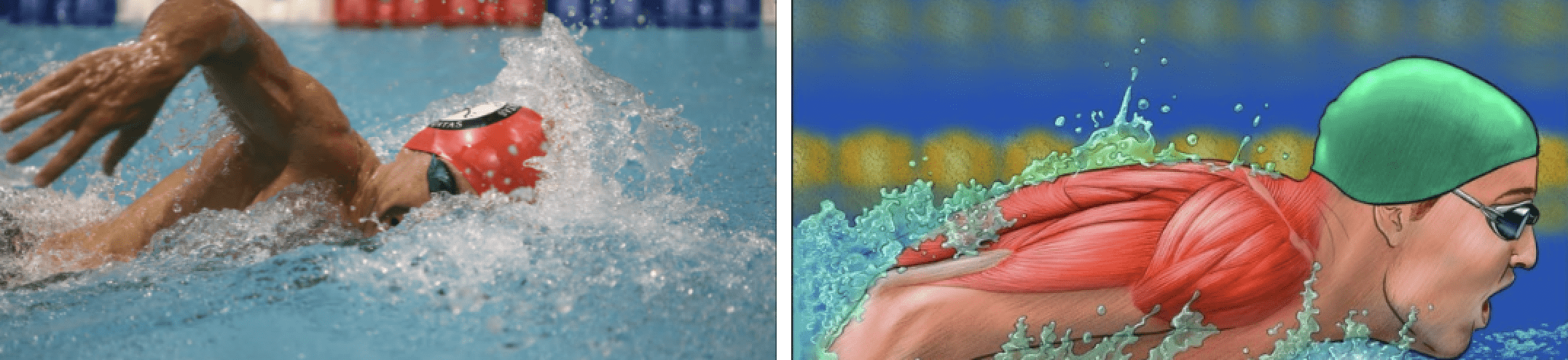 How to overcome swimmers shoulder